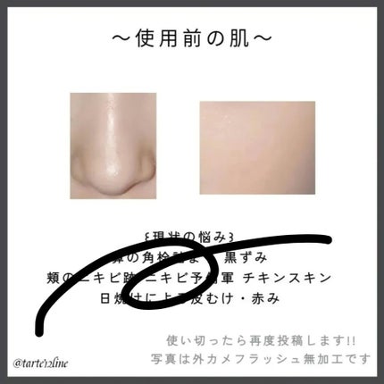 レチノール PDRN アドバンスド エッセンスローション/innisfree/化粧水を使ったクチコミ(4枚目)