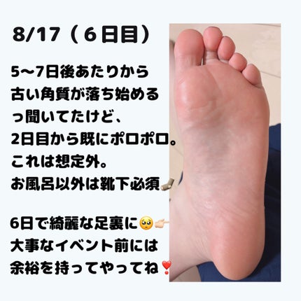 Annyo フットパック カウ柄 ヴァーベナの香り 1回分/ピエラス/レッグ・フットケアの画像