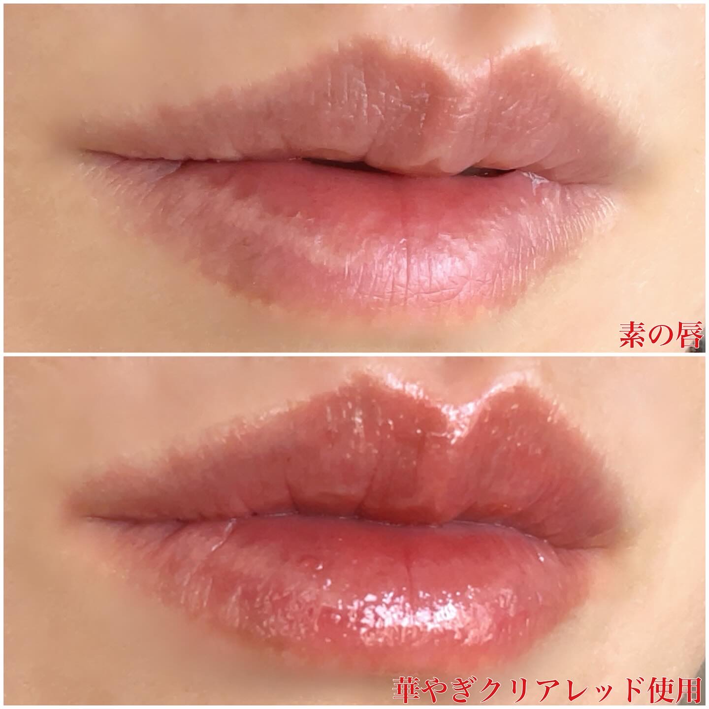 アルブラン リップセラムバーム/ALBLANC/リップバームを使ったクチコミ（3枚目）