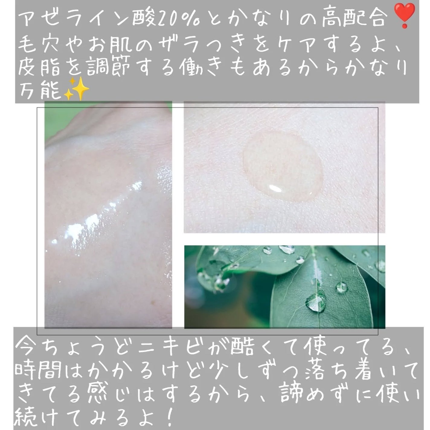 アクネクスアンプル/EIOM/美容液を使ったクチコミ(3枚目)