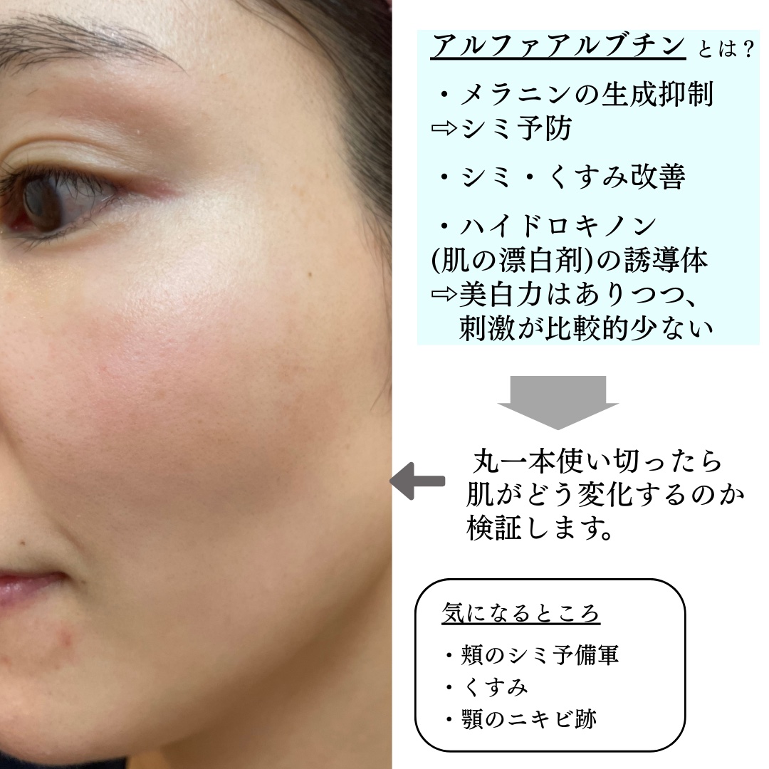 RXザ・アルファアルブチン2 ニキビ跡ケアセラム 本体/COSRX/美容液を使ったクチコミ（3枚目）