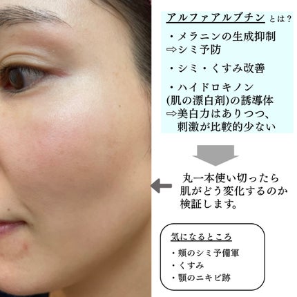 RXザ・アルファアルブチン2 ニキビ跡ケアセラム/COSRX/美容液を使ったクチコミ(3枚目)