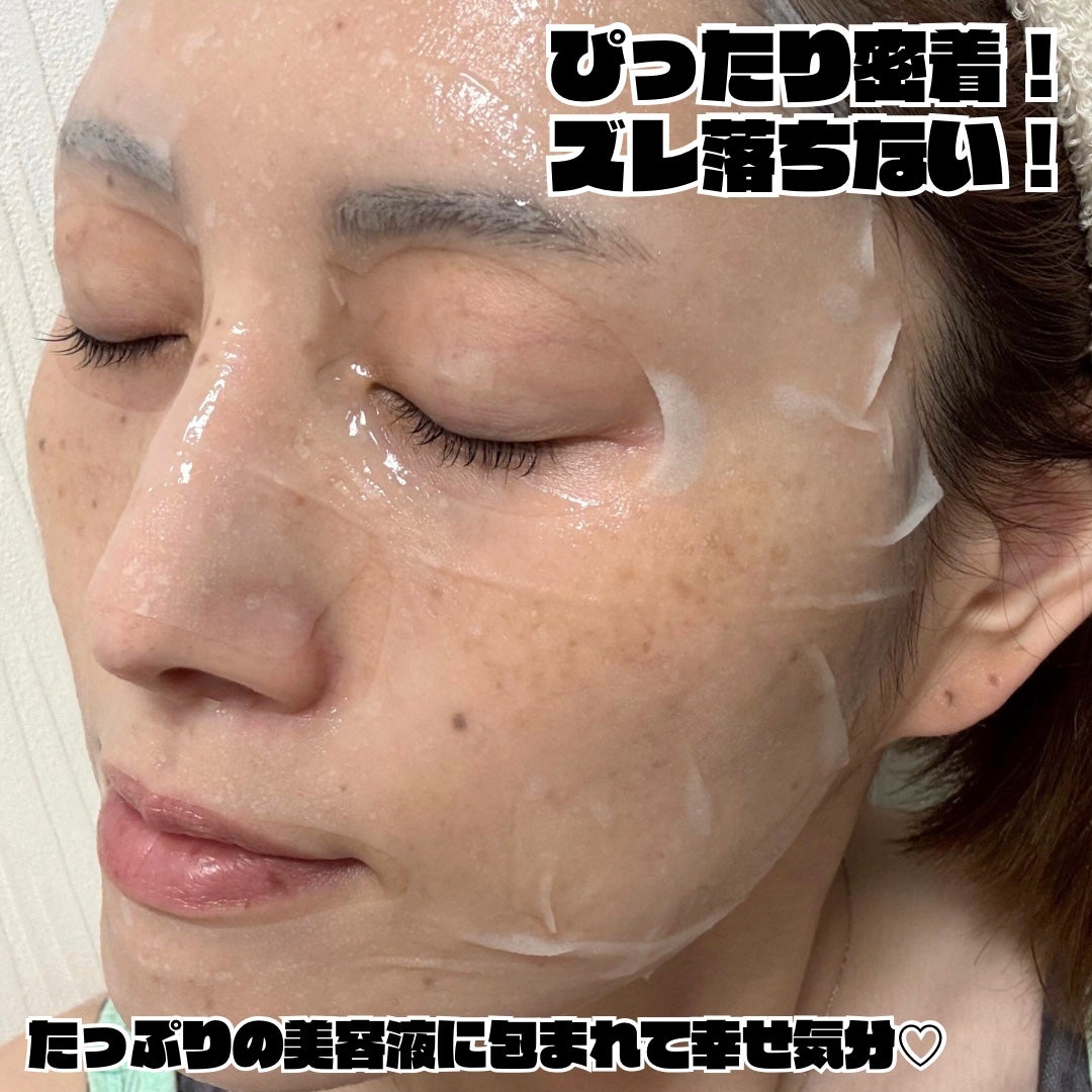 メディリフト ニードルリフトシートマスク/YA-MAN TOKYO JAPAN/シートマスク・パックを使ったクチコミ(4枚目)