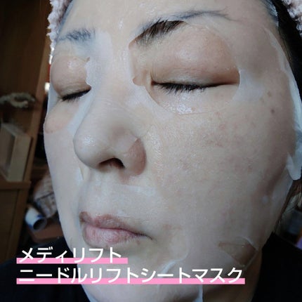 メディリフト ニードルリフトシートマスク/YA-MAN TOKYO JAPAN/シートマスク・パックを使ったクチコミ(2枚目)