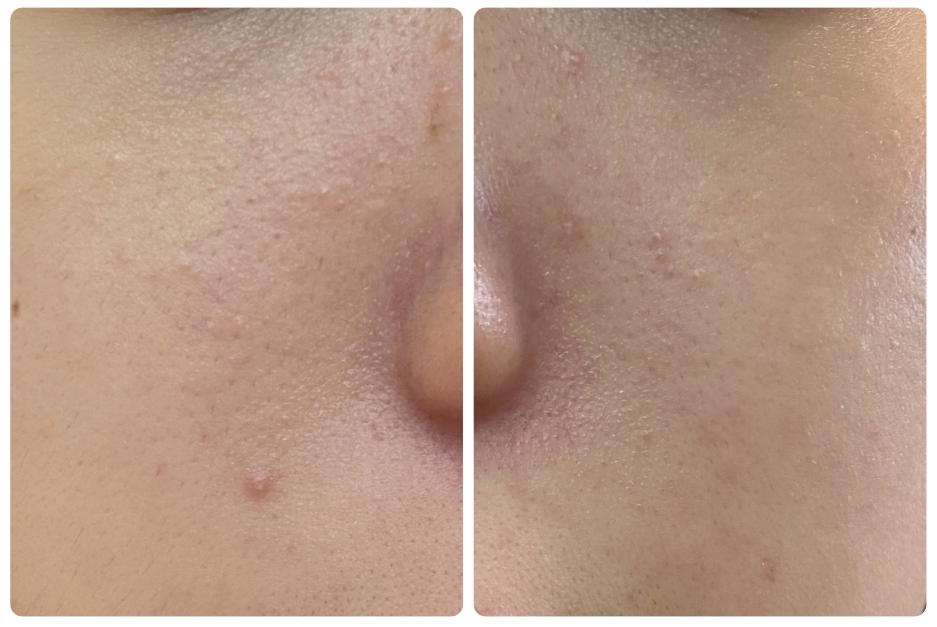 Hadaral 十味敗毒湯錠(医薬品)/大峰堂/その他を使ったクチコミ（3枚目）