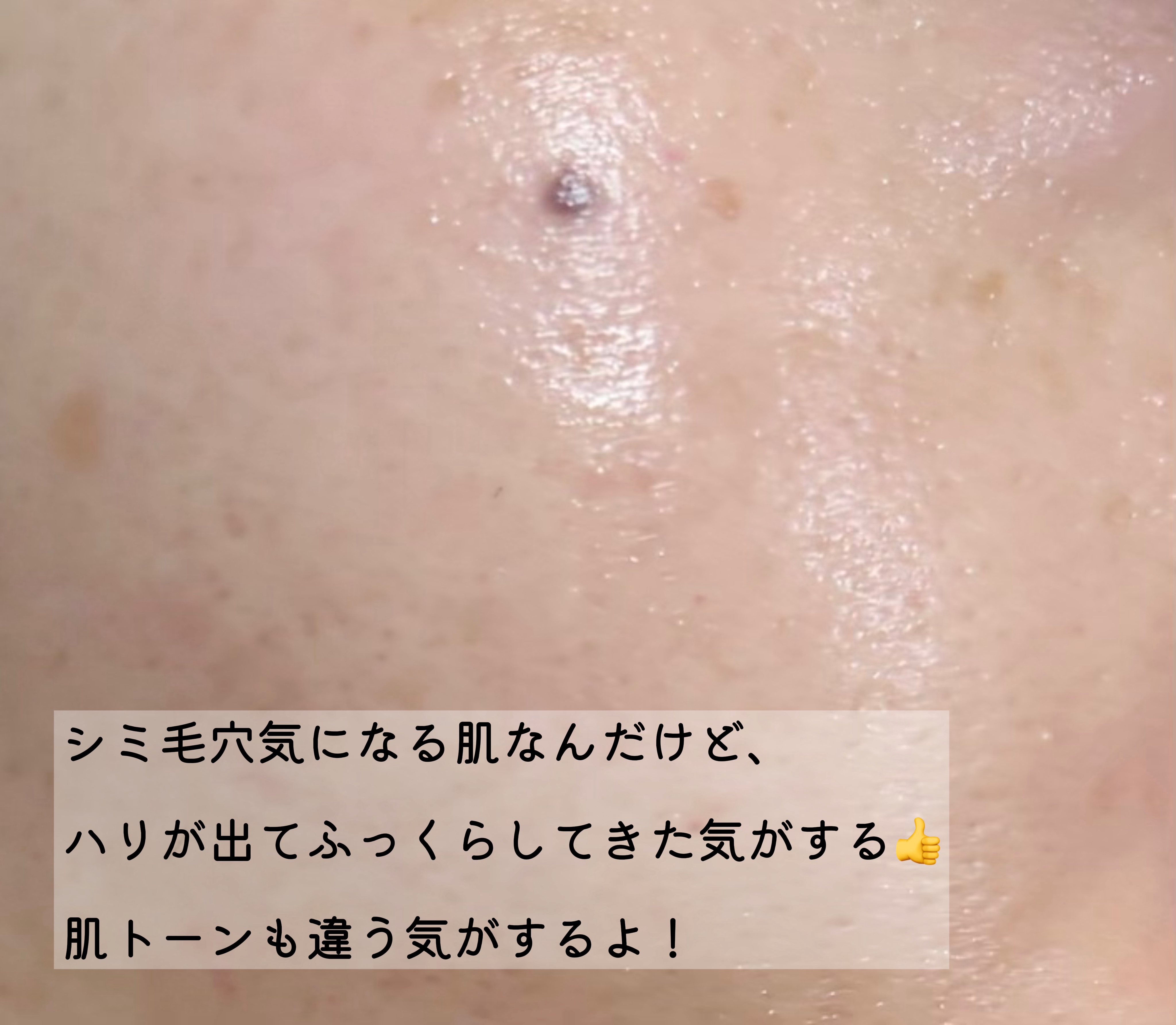 PDRN 1000 Plus Cream/Rejuveon/フェイスクリームを使ったクチコミ（3枚目）