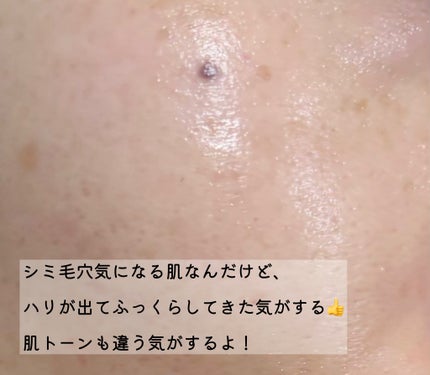 PDRN 1000 Plus Cream/Rejuveon/フェイスクリームを使ったクチコミ(3枚目)