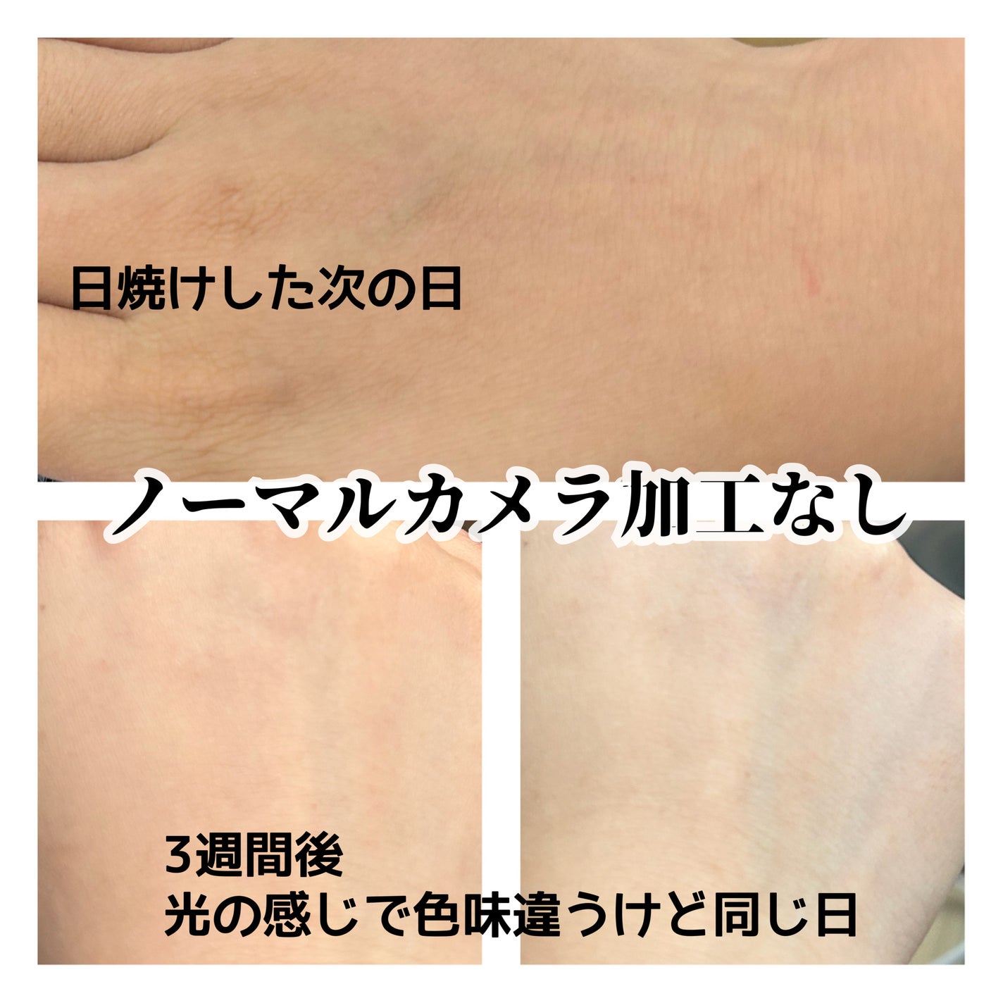 アネッサ スキンセラム<医薬部外品>/アネッサ/フェイスクリームを使ったクチコミ(2枚目)