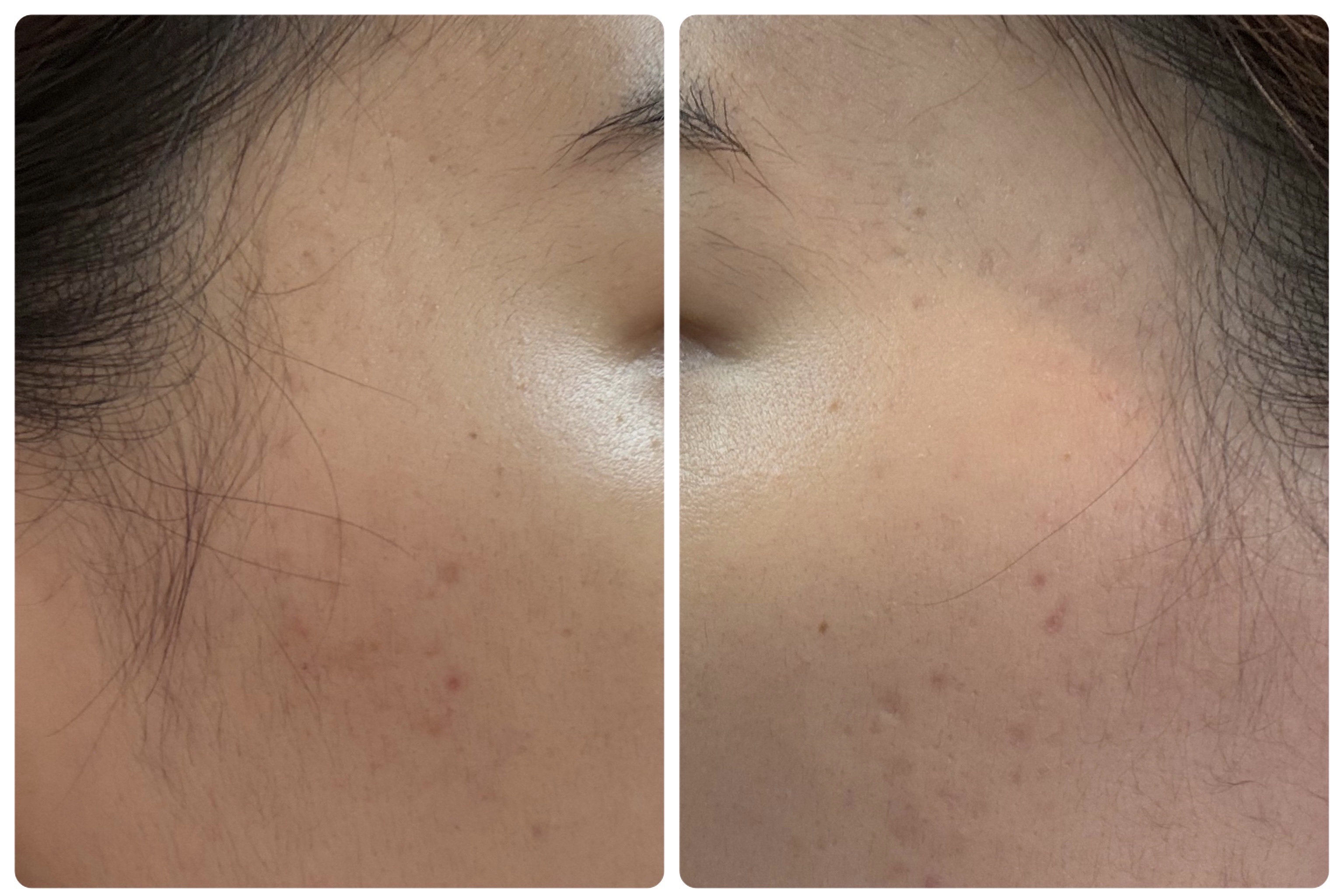 Hadaral 十味敗毒湯錠(医薬品)/大峰堂/その他を使ったクチコミ（2枚目）