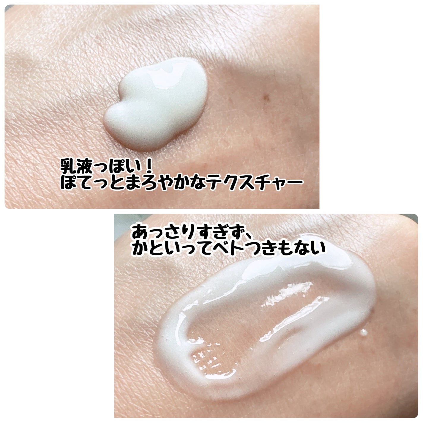 薬用Wホワイトエッセンス/ドクターベルツ/美容液を使ったクチコミ(2枚目)