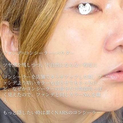 ディオールスキン フォーエヴァー スキン コレクト コンシーラー/Dior/リキッドコンシーラーを使ったクチコミ(7枚目)