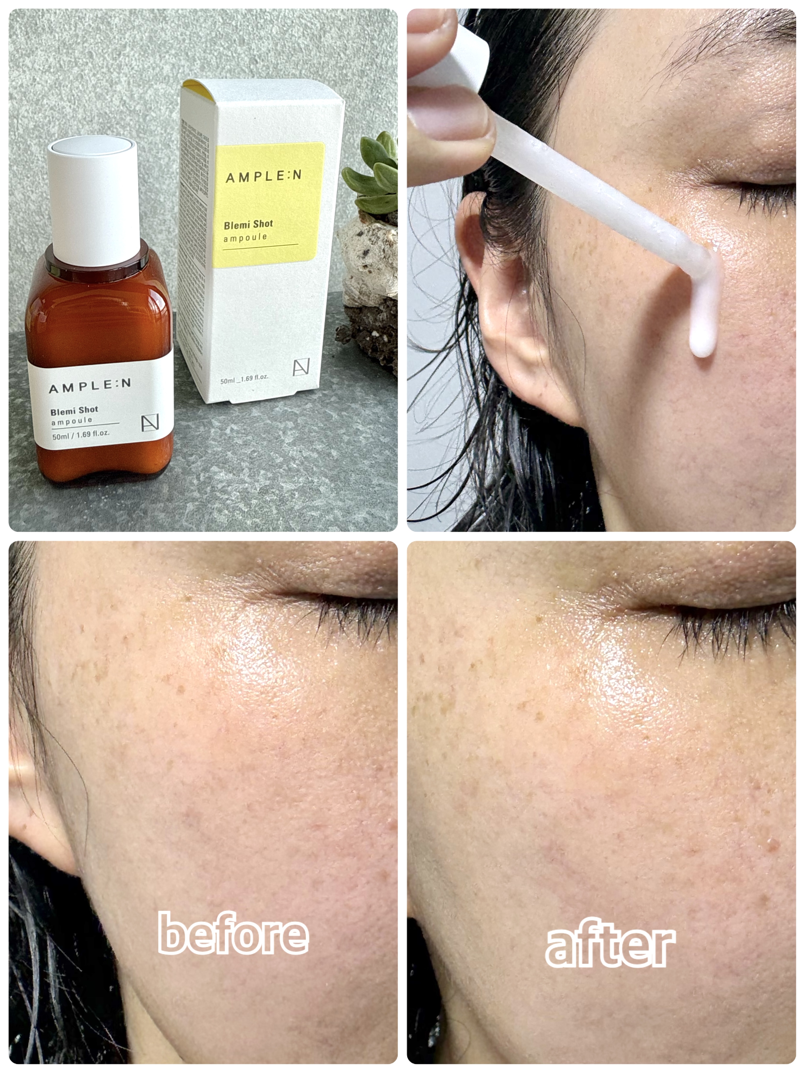 ブレミショット美容液/AMPLE:N/美容液を使ったクチコミ（2枚目）