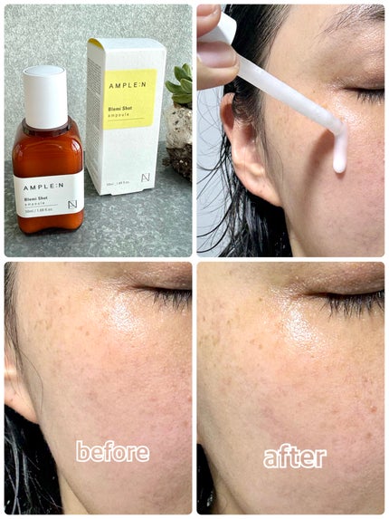 ブレミショット美容液/AMPLE:N/美容液を使ったクチコミ(2枚目)