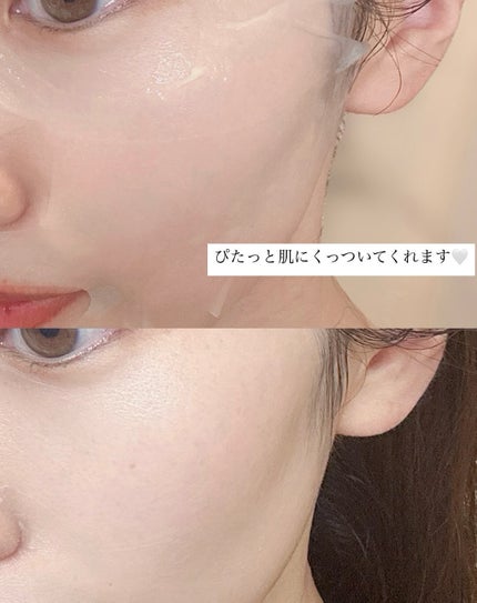 メディリフト ニードルリフトシートマスク/YA-MAN TOKYO JAPAN/シートマスク・パックを使ったクチコミ(4枚目)