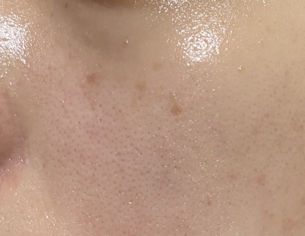 ビタミンアンプル2ml（5本入り）/Spela/美容液を使ったクチコミ（3枚目）