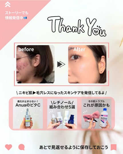 ピンクグルタチオン デイリースペシャルマスク/Milk Touch/シートマスク・パックを使ったクチコミ(7枚目)