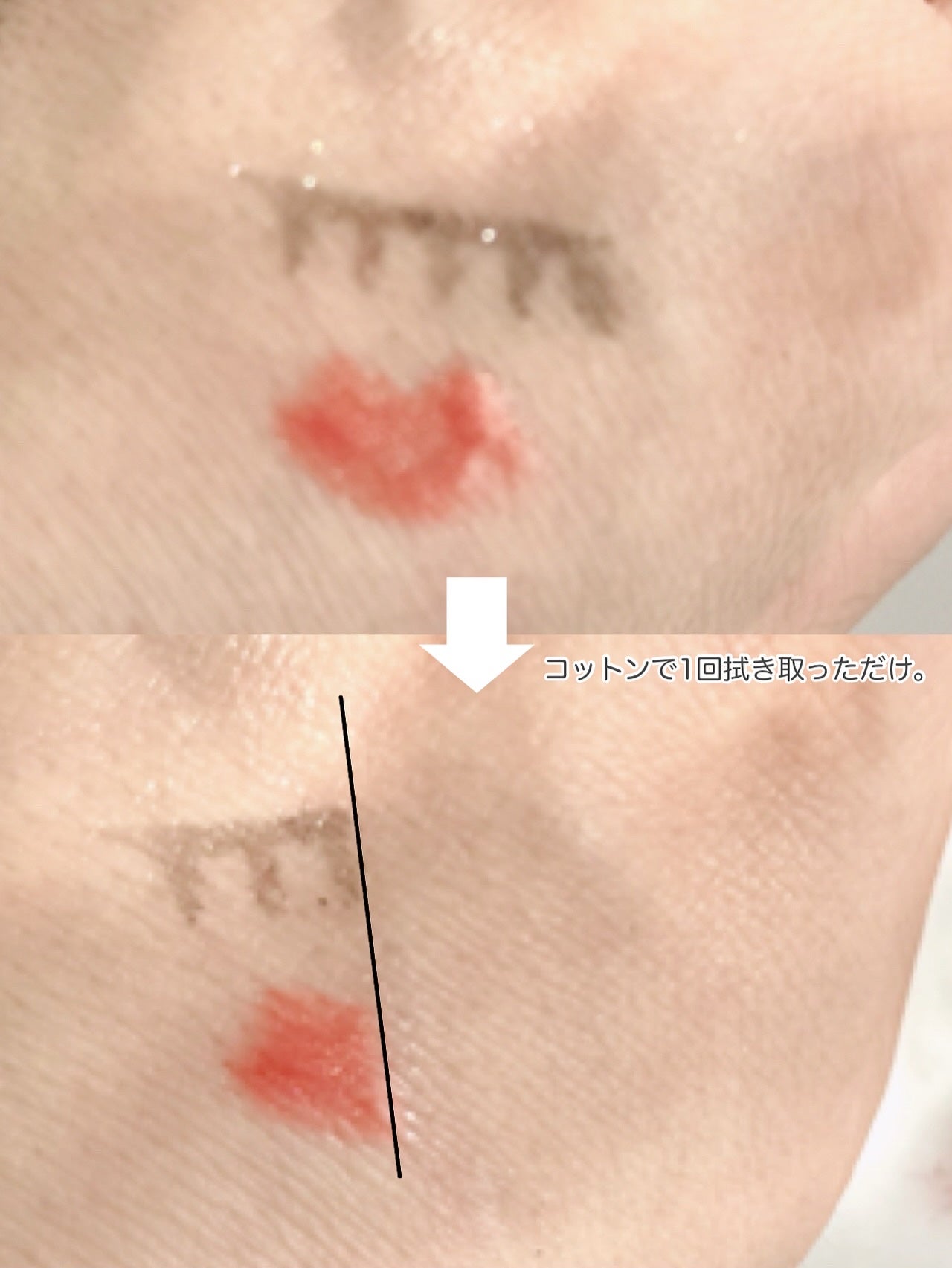 イドラビオ エイチツーオー/ビオデルマ/クレンジングウォーターを使ったクチコミ(3枚目)