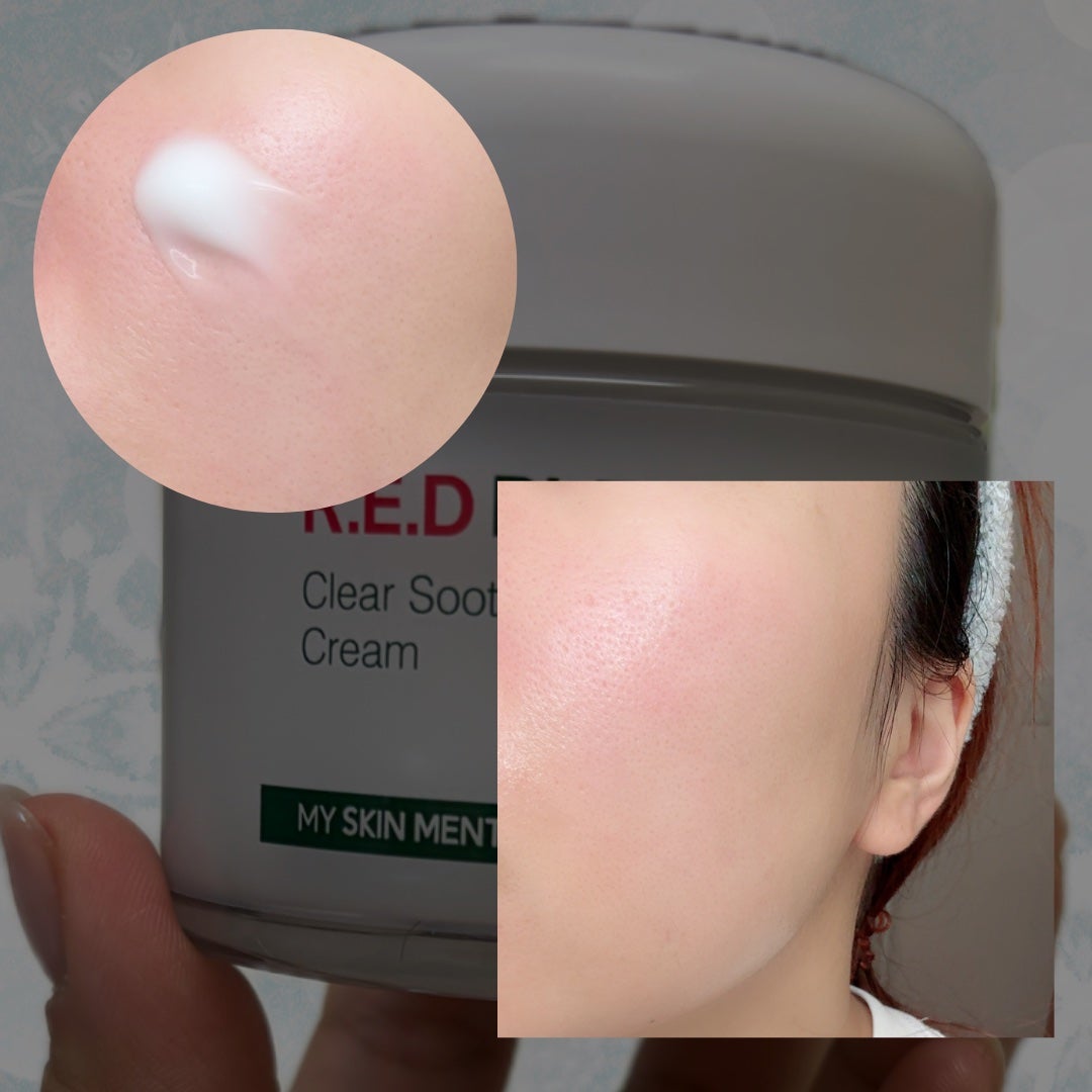 レッドブレミッシュ クリアスージングクリーム/Dr.G/フェイスクリームを使ったクチコミ(3枚目)