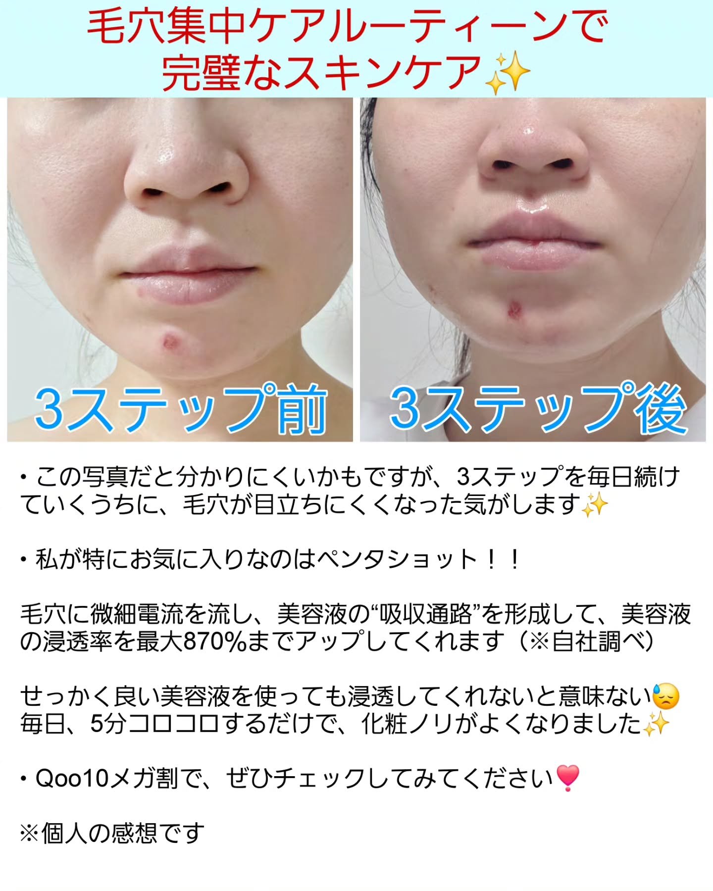 ポアタイトニングブーストセラム/CELORABY/美容液を使ったクチコミ（3枚目）