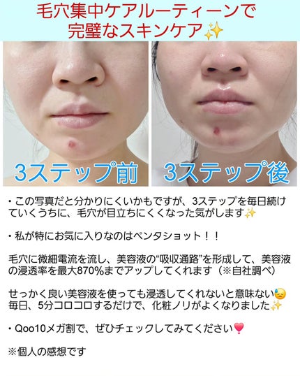 ポアタイトニングブーストセラム/CELORABY/美容液を使ったクチコミ(3枚目)