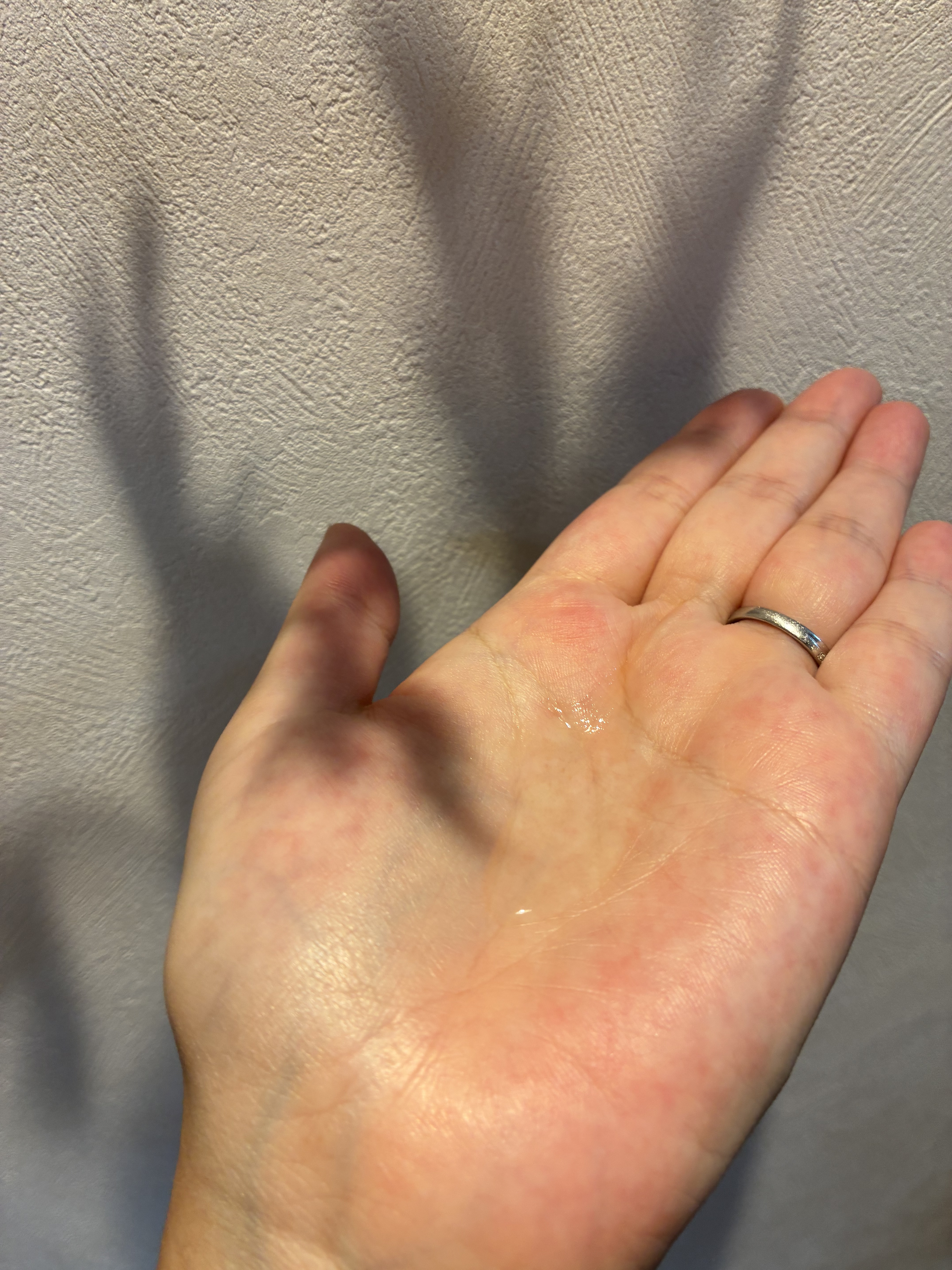 タカミスキンピール/タカミ/ブースター・導入液を使ったクチコミ（3枚目）