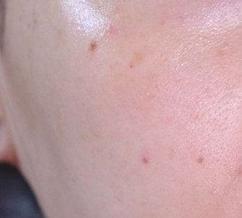 ライク ホワイト ブロッサム エッセンス トナー /GINGER6/化粧水を使ったクチコミ（1枚目）