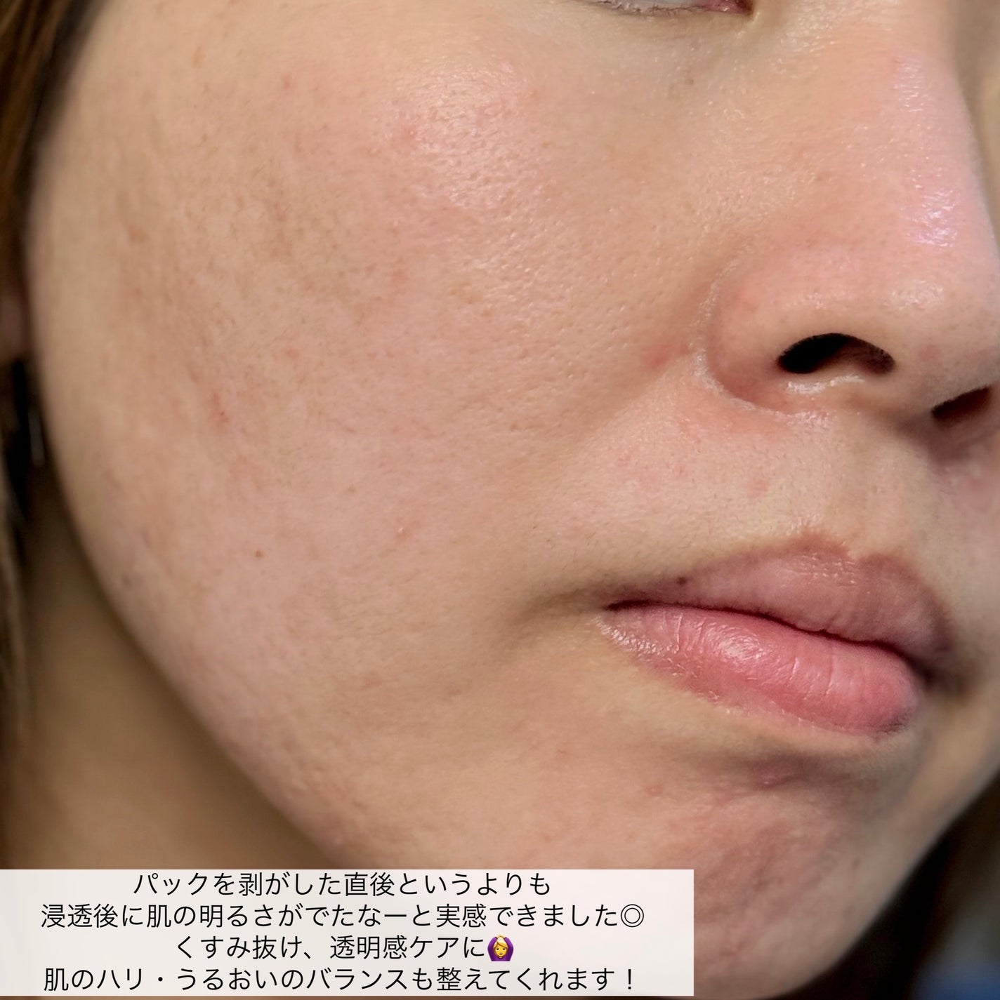 ルルルン オーラブライトマスク W/ルルルン/シートマスク・パックを使ったクチコミ(6枚目)