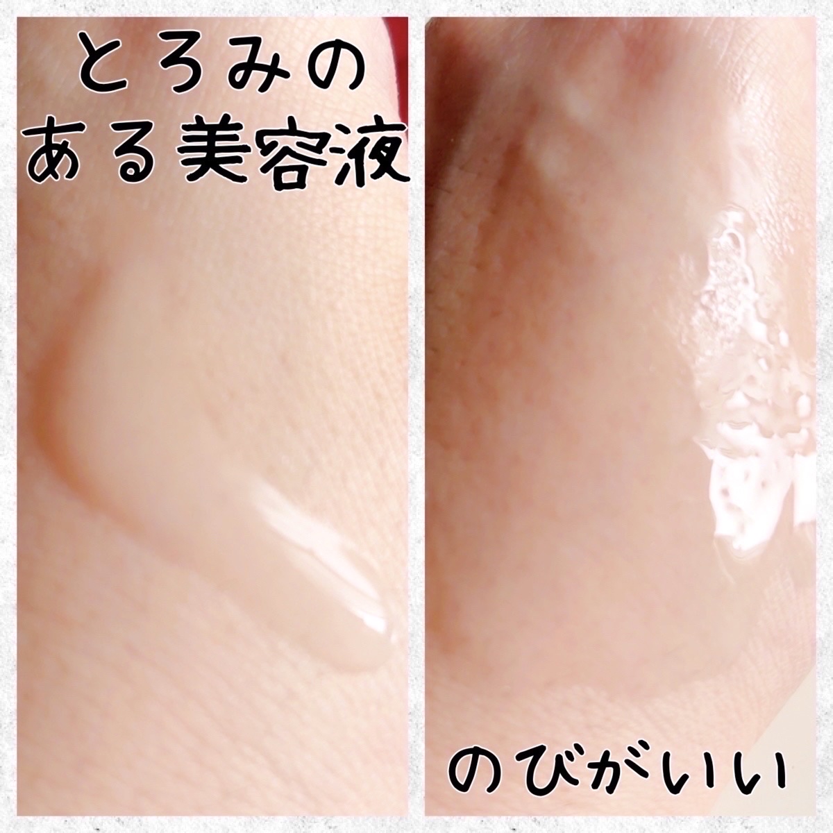 ハイドラアンプルⅡ/9Wishes/美容液を使ったクチコミ（2枚目）