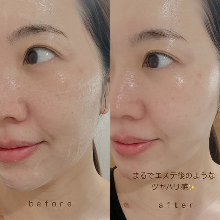 30秒クイックバブルマスク1+1セット/MENOKIN/シートマスク・パックを使ったクチコミ(7枚目)