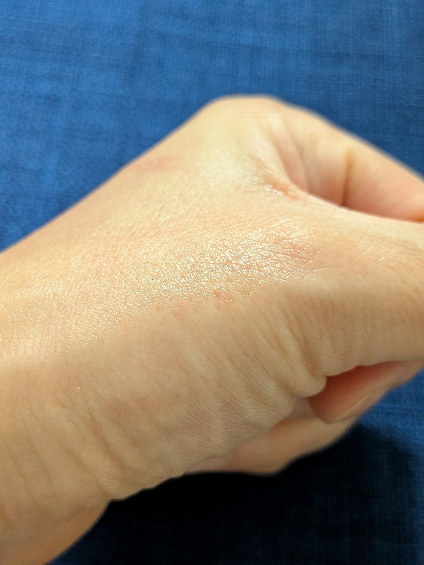 マデカ トーニング エッセンス トリートメント/センテリアン24/化粧水を使ったクチコミ(2枚目)