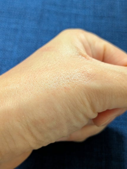 マデカ トーニング エッセンス トリートメント/センテリアン24/化粧水を使ったクチコミ(2枚目)