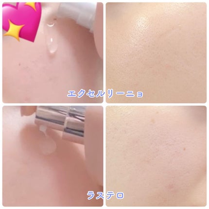 ラステロPDRNホワイトグローアンプル/ARNE/美容液を使ったクチコミ(4枚目)