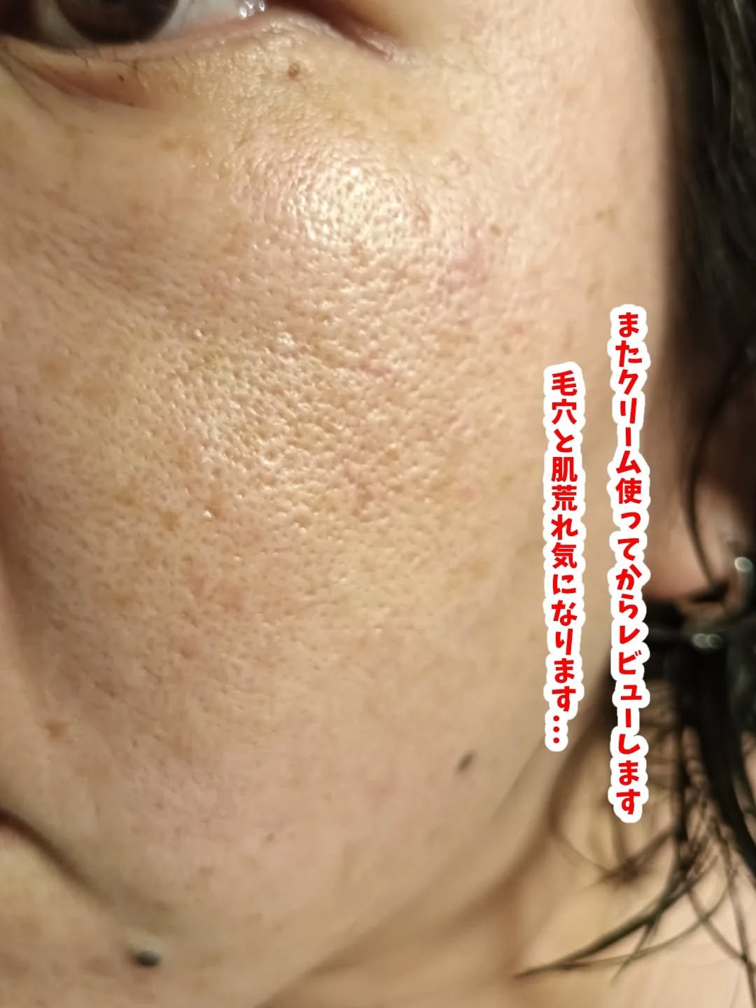 ダーマジェンシー ゼロカ81 クリーム/DERMAGENCY/フェイスクリームを使ったクチコミ（3枚目）