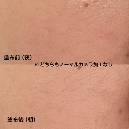 アビブ グルタチオンソームダークスポットセラムビタドロップ/Abib /美容液を使ったクチコミ(4枚目)