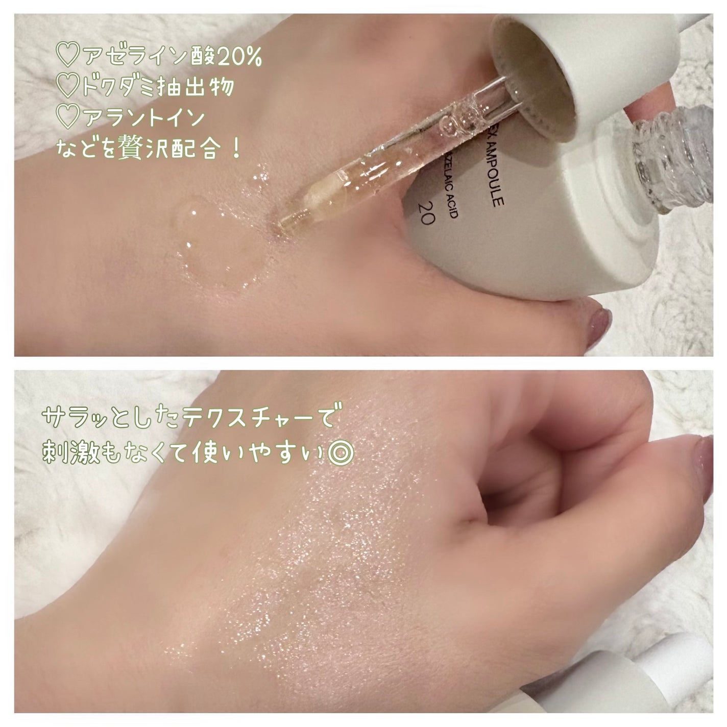 アクネクスアンプル/EIOM/美容液を使ったクチコミ(2枚目)