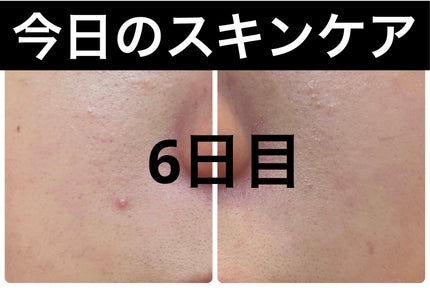 クリアアップローション 1/IPSA/化粧水を使ったクチコミ(1枚目)