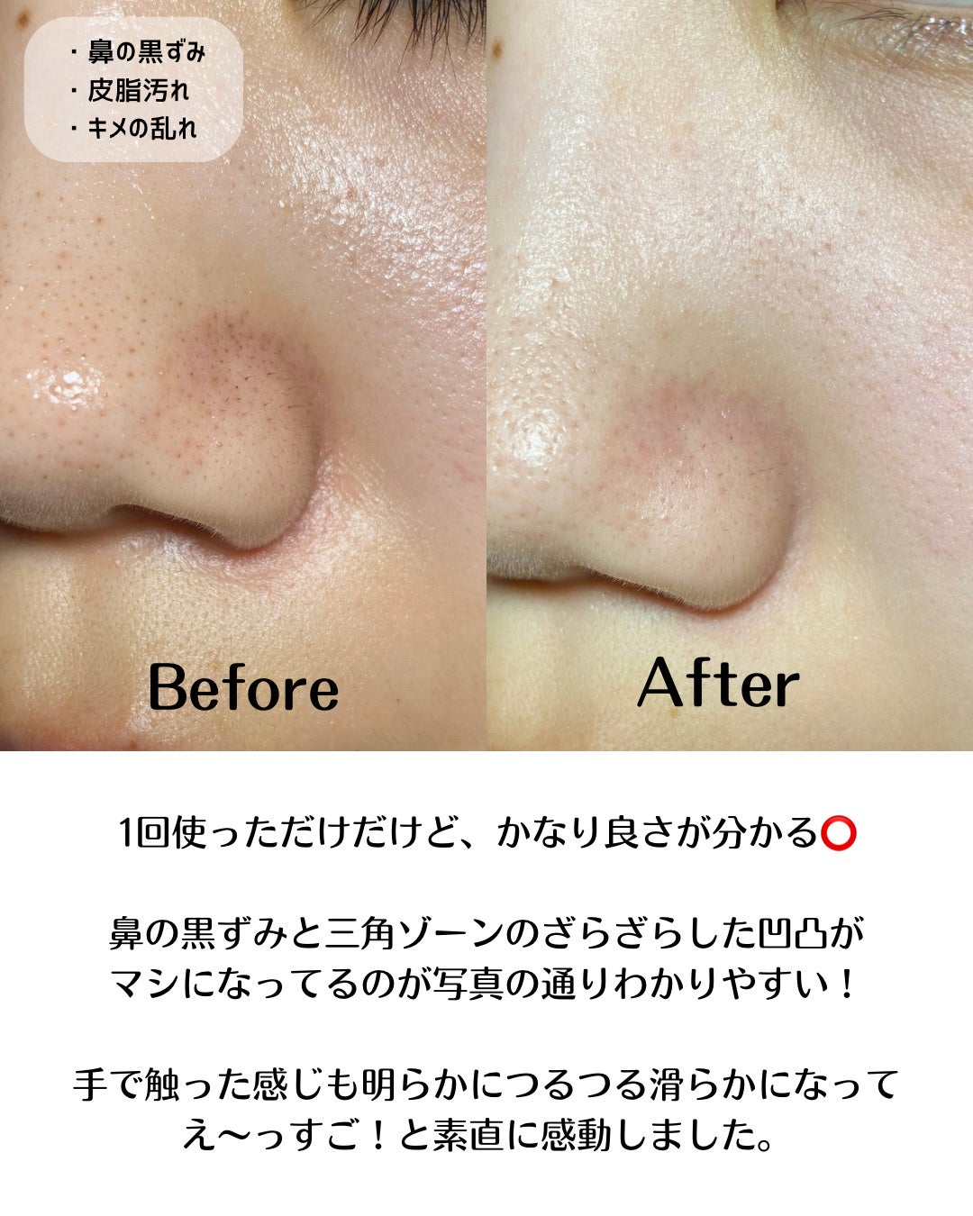 AZケア クレンジングオイル/VT/オイルクレンジングを使ったクチコミ(6枚目)