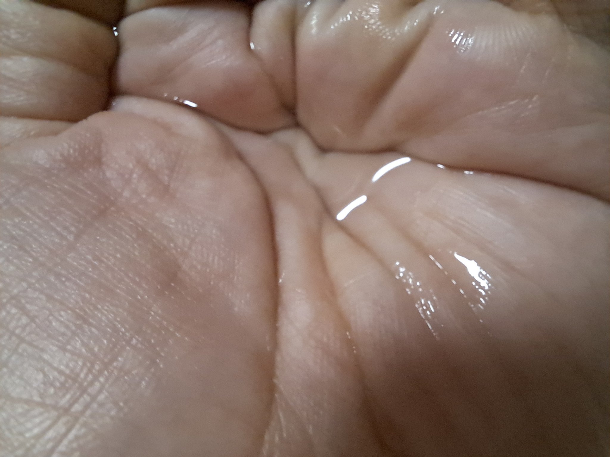 タカミスキンピール/タカミ/ブースター・導入液を使ったクチコミ（3枚目）