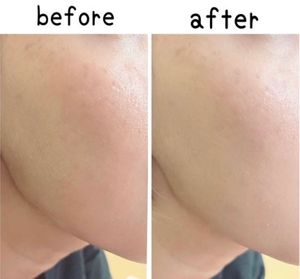 クラウドフィルタークッション/ETUDE/クッションファンデーションを使ったクチコミ(8枚目)