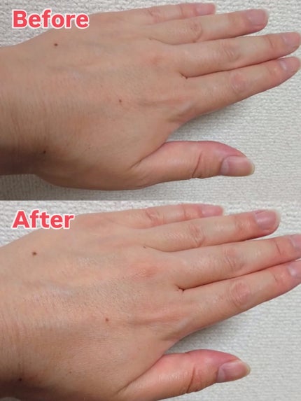 ビトック フォー デイリー RX/Differ&Deeper/美容液を使ったクチコミ(5枚目)