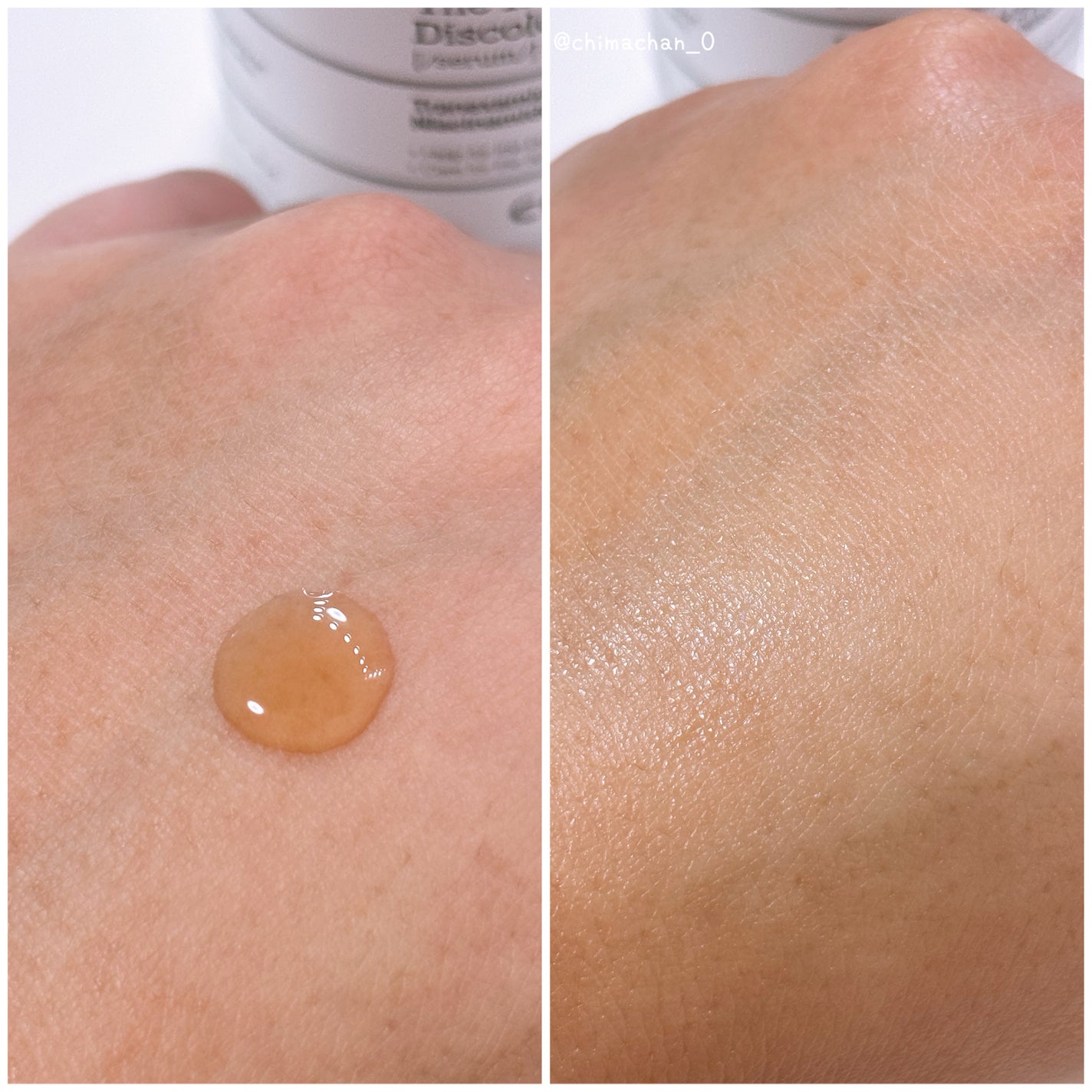 RXザ・アルファアルブチン2 ニキビ跡ケアセラム/COSRX/美容液を使ったクチコミ(2枚目)