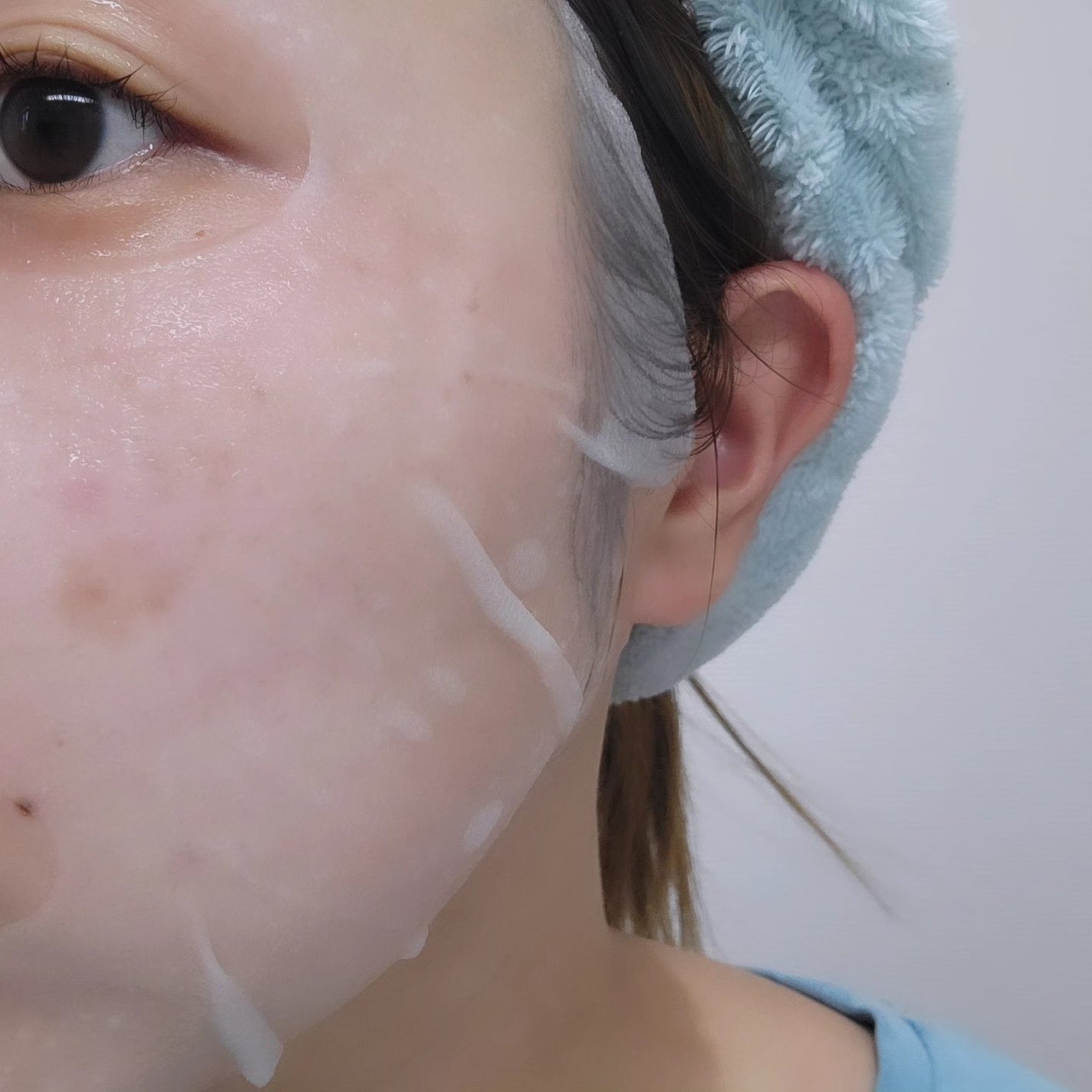 メディリフト ニードルリフトシートマスク/YA-MAN TOKYO JAPAN/シートマスク・パックを使ったクチコミ(4枚目)