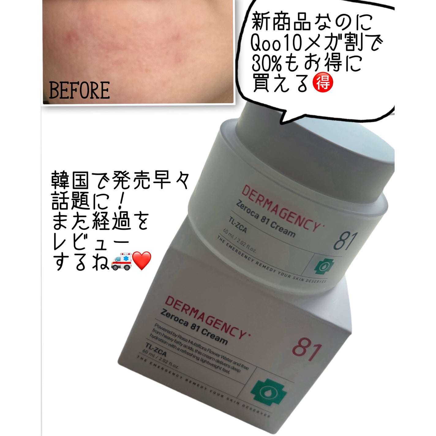 ダーマジェンシー ゼロカ81 クリーム/DERMAGENCY/フェイスクリームを使ったクチコミ(4枚目)