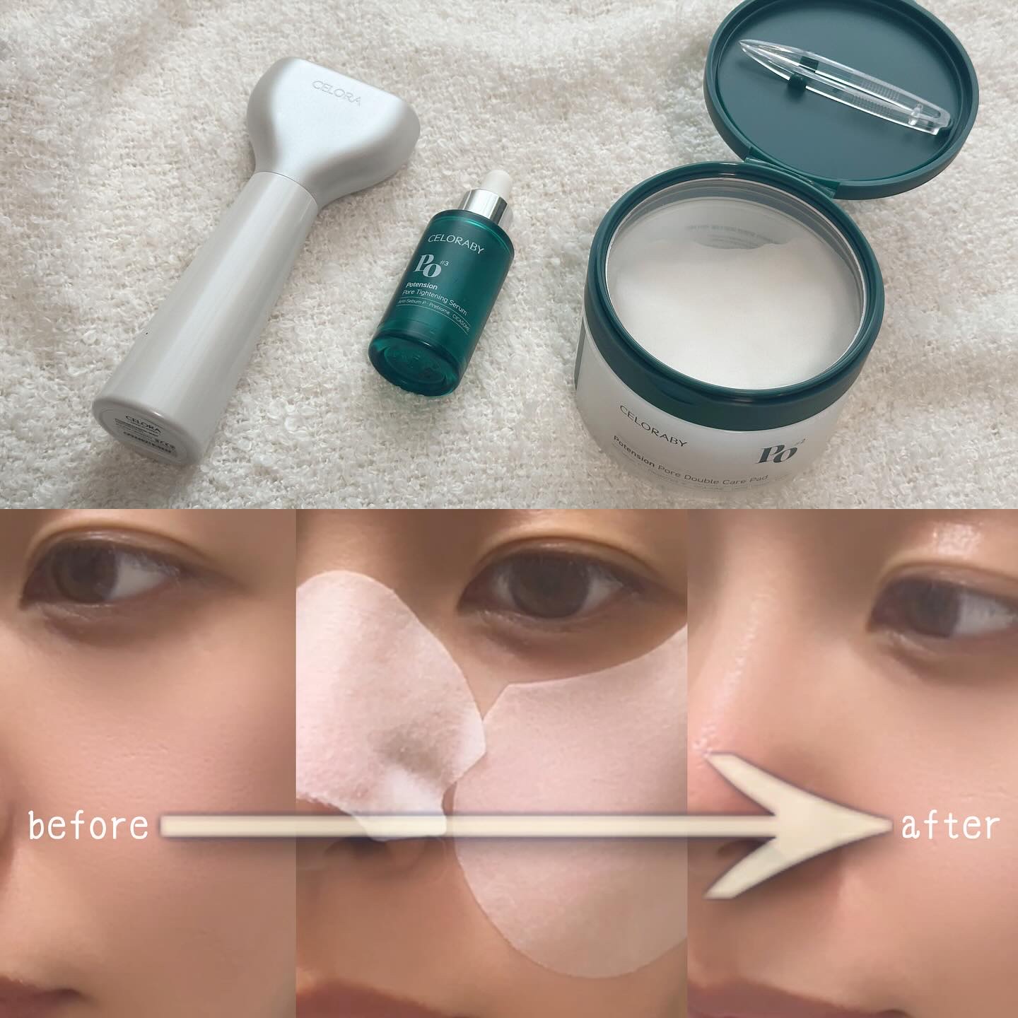 ポアタイトニングブーストセラム/CELORABY/美容液を使ったクチコミ（3枚目）