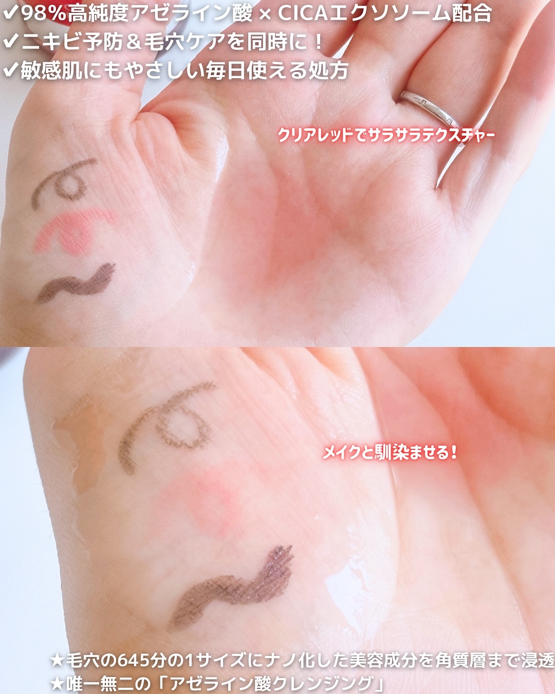 AZケア クレンジングオイル/VT/オイルクレンジングを使ったクチコミ（2枚目）