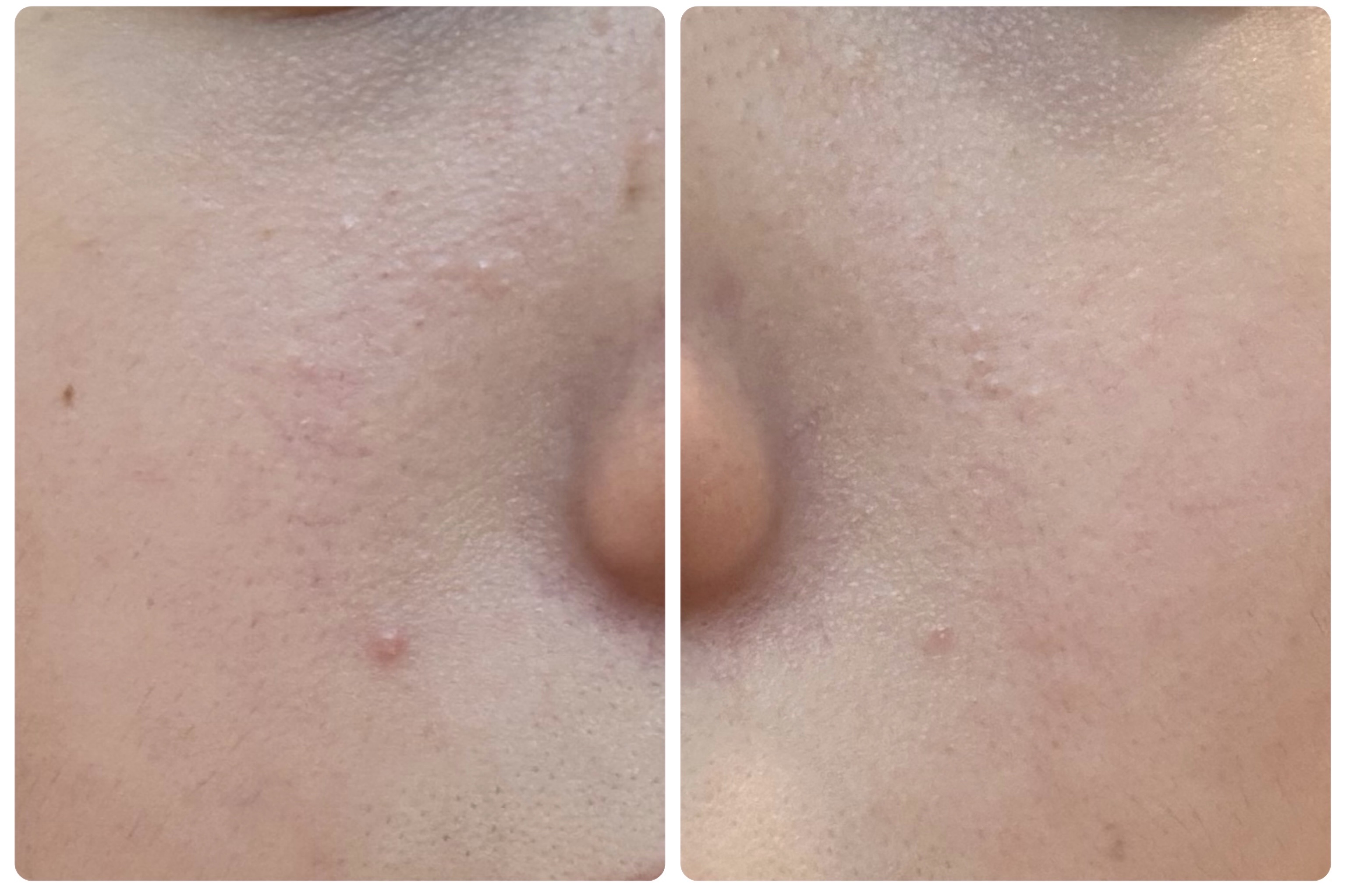 Hadaral 十味敗毒湯錠(医薬品)/大峰堂/その他を使ったクチコミ（3枚目）