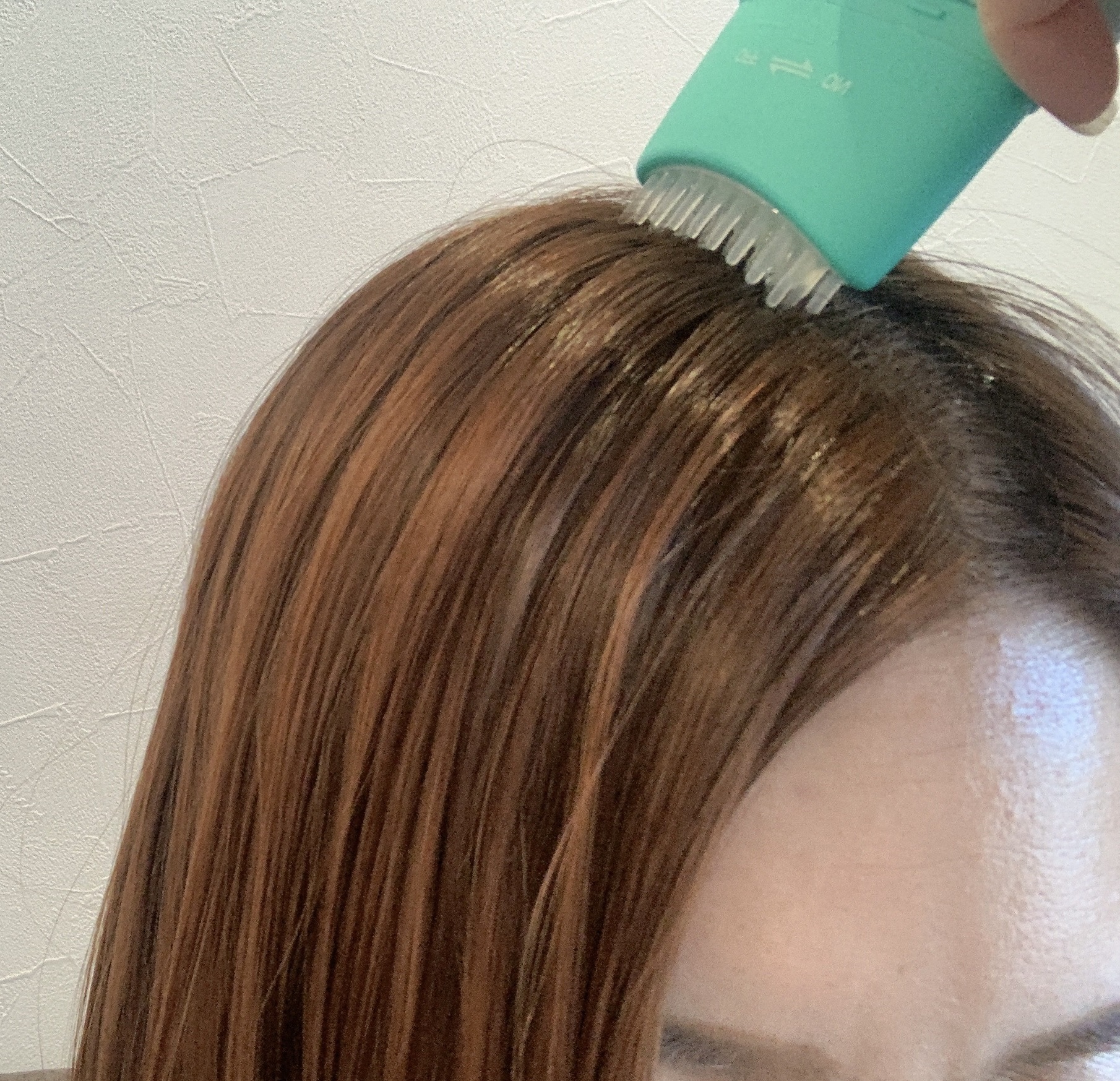 スカルプターンヘアアンプル/リリーイブ/頭皮ローションを使ったクチコミ（3枚目）