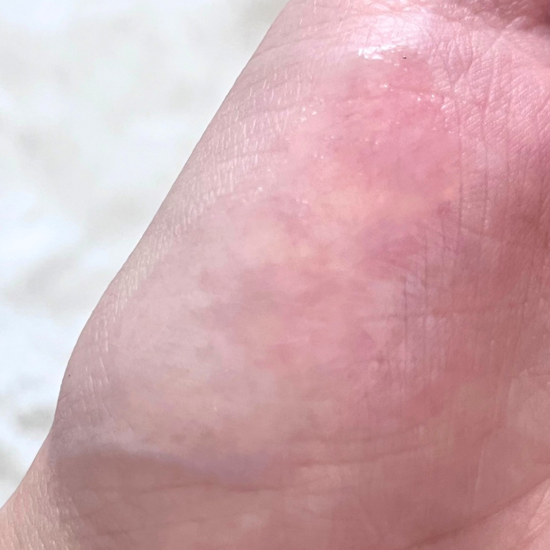 ダーマジェンシー ゼロカ81 セラム/DERMAGENCY/美容液を使ったクチコミ（3枚目）