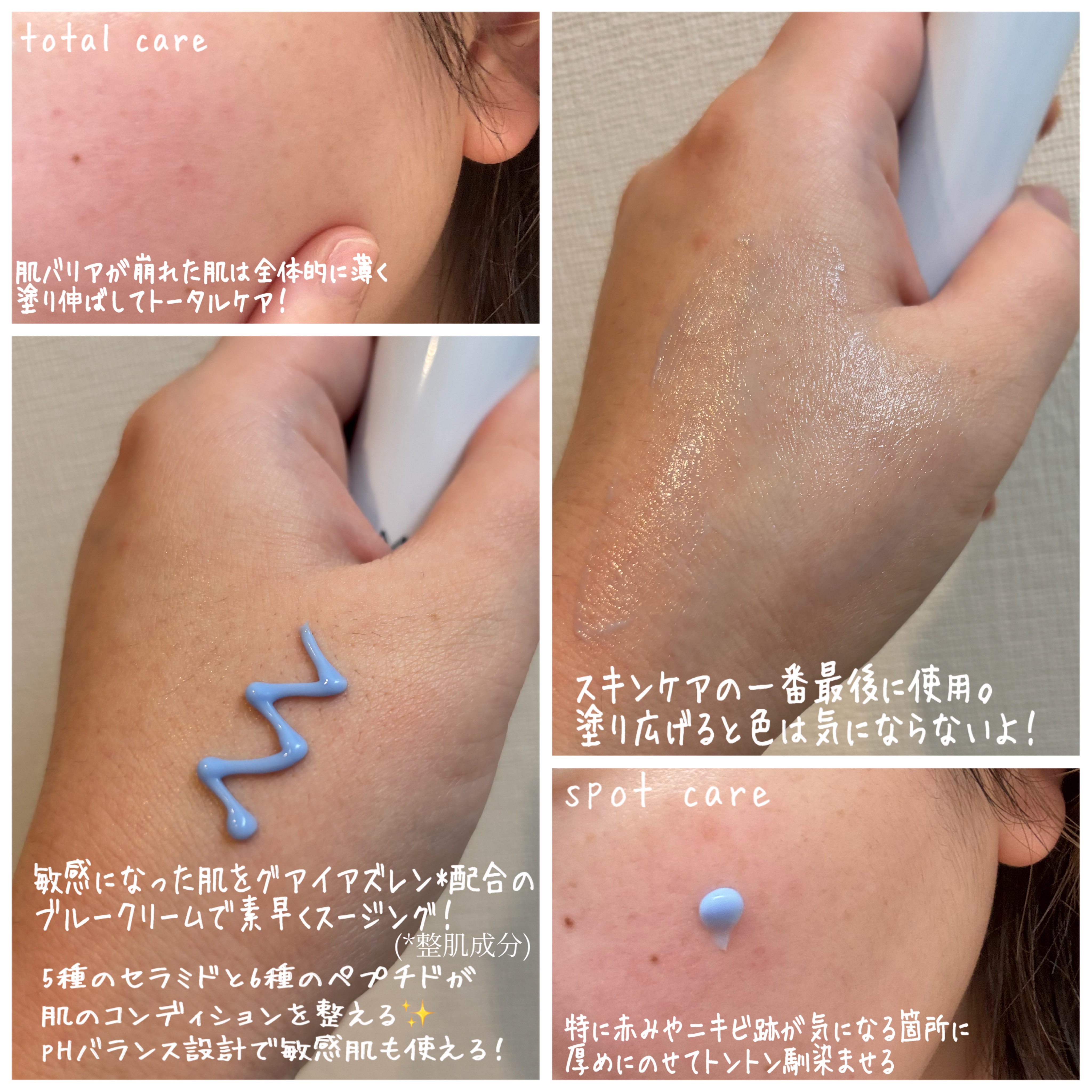 PHセンシティブスポットクリーム/SAM'U/フェイスクリームを使ったクチコミ（2枚目）