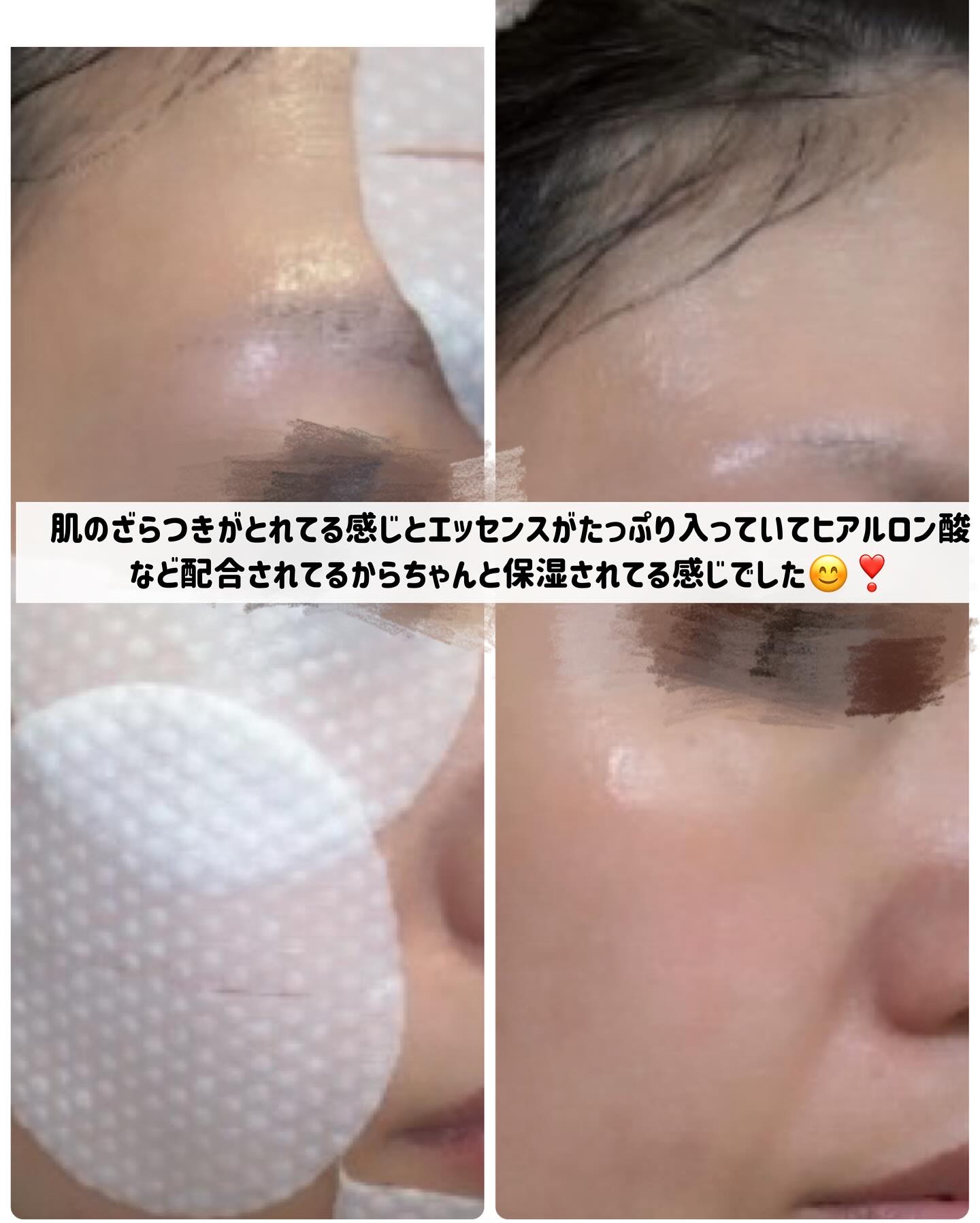 PHセンシティブトナーパッド/SAM'U/トナーパッドを使ったクチコミ（3枚目）